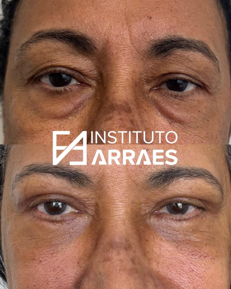 01-5da1bfba-6375-4dd6-80d9-8b2df29f8edf